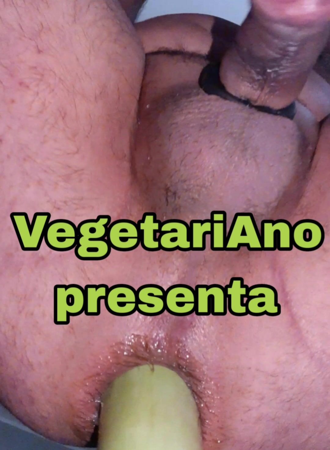 Sfondamento anale
