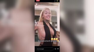 Meglio rifarsi le tette che farsi i mariti delle altre