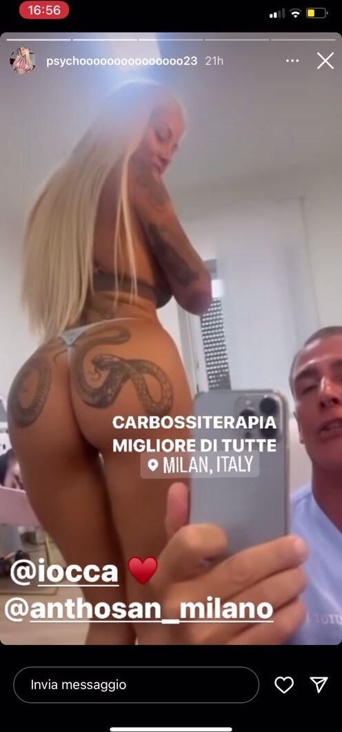 Carbossiterapia e lei ti fa tirare il cazzo