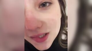 Sgrillettamento studentessa 19 enne