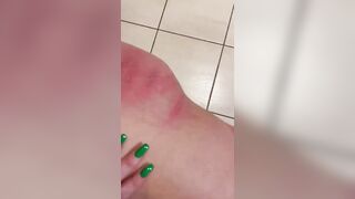 Quanti bei segni sulla tua pelle